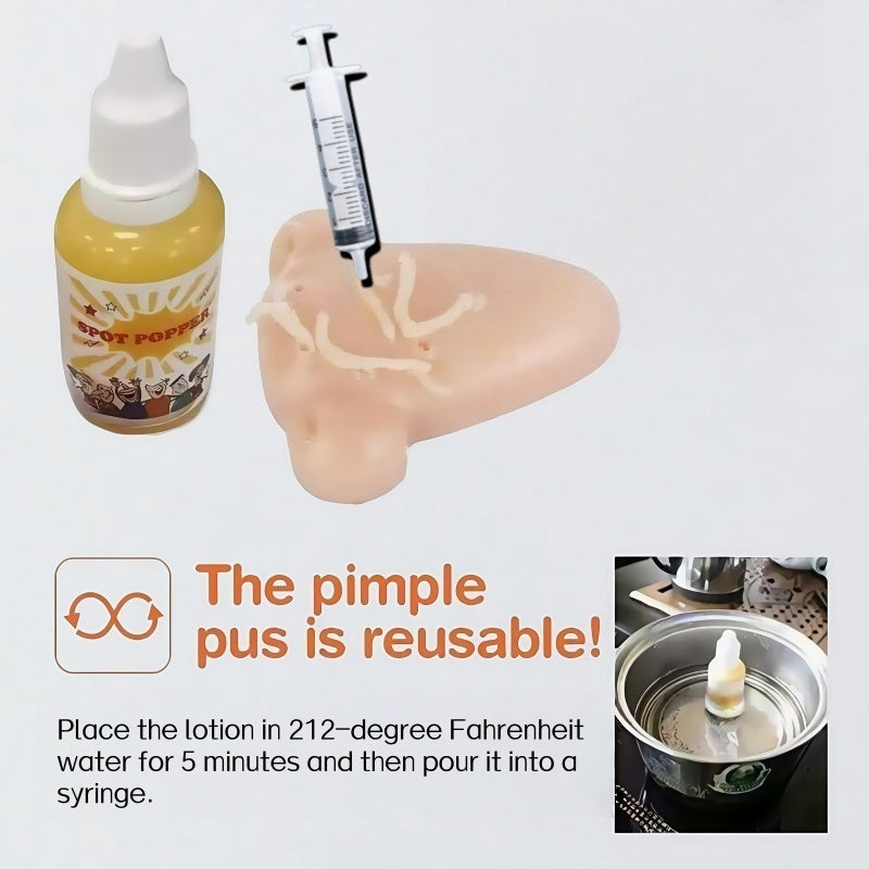 DlY Pimple Popper Nose A